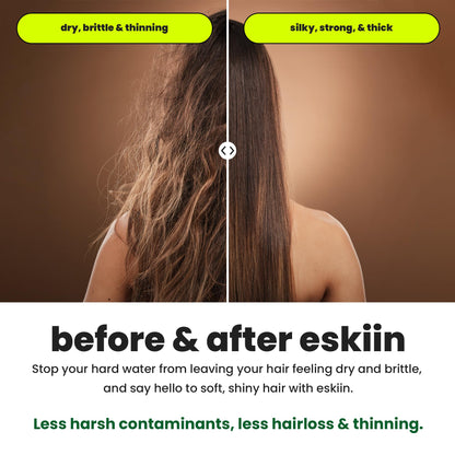 ESKIIN Filtered Shower Head - High Pressure Water Softener