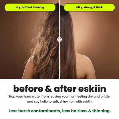 ESKIIN Filtered Showerhead - High Pressure Water Softener